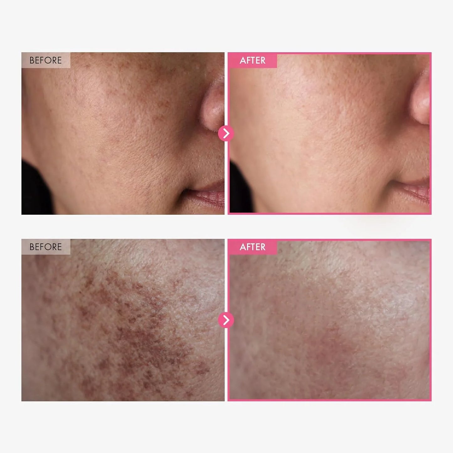 Arbutin 7.0 + TXA 4.0 Cream (pre-order)