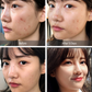 AHA BHA PHA 14 Days Super Miracle Spot All Kill Cream 30ml